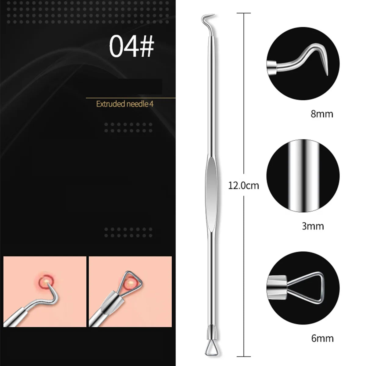 4pcs Acne & Blackhead Comedone Skin Remover