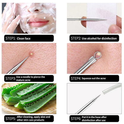 4pcs Acne & Blackhead Comedone Skin Remover