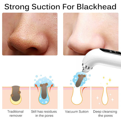 Blackhead Pore Remover