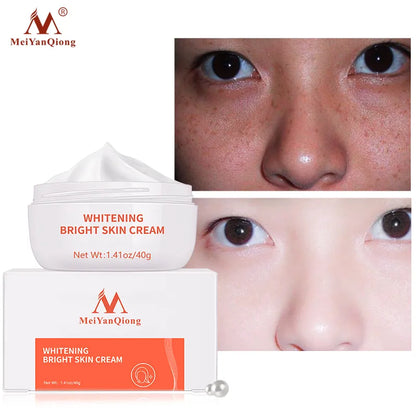 Face Whitening Freckle Moisturizing Cream