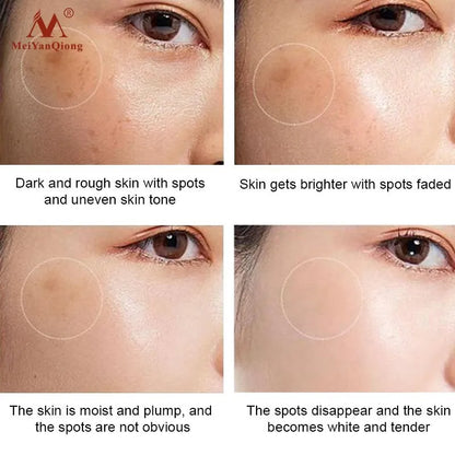 Face Whitening Freckle Moisturizing Cream